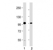 Western blot testing of BMP1 antibody at 1:2000: Lane 1) human A549 and 2) U-251 MG cell lysate. Predicted molecular weight ~111 kDa.
