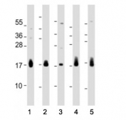 Western blot testing of CD59 antibody at 1:2000: Lane 1) human HUVEC, 2) BxPC-3, 3) PC-3, 4) breast and 5) placenta lysate. Predicted molecular weight ~14/18-20 kDa (unmodified/glycosylated).