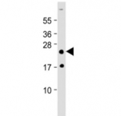 Western blot testing of HOXA7 antibody at 1:2000 + human skeletal muslce lysate. Predicted molecular weight ~25 kDa.