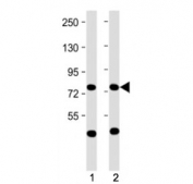 Western blot testing of MPL antibody at 1:2000: Lane 1) human Daudi and 2) HepG2 cell lysate. Predicted molecular weight ~71 kDa.