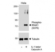 Western blot analysis of lysates from the human HeLa cell line, untreated or treated with IL-1 beta (20ng/ml) + Calyculin A (100nM), using phospho-IRAK1 antibody (upper) or Tubulin Ab (lower).