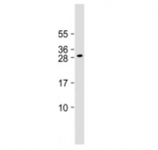 Western blot testing of DLX1 antibody at 1:2000 + mouse brain lysate. Predicted molecular weight ~27 kDa.