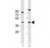 Western blot testing of Prostaglandin D2 Receptor antibody at 1:2000: Lane 1) human HepG2 and 2) Y79 cell lysate. Predicted molecular weight ~40 kDa.