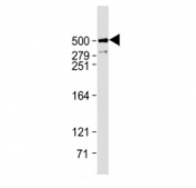 Western blot testing of Plectin antibody at 1:1000 + human U-2OS cell lysate. Predicted molecular weight ~532 kDa.
