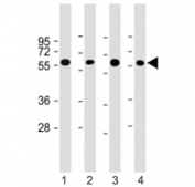 Western blot testing of CRY2 antibody at 1:4000: Lane 1) human HepG2, 2) (h) heart lysate; 3) (h) liver lysate and 4) mouse liver lysate. Predicted molecular weight ~67 kDa.