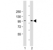 Western blot testing of HACE1 antibody at 1:2000: Lane 1) human HEK293 and 2) 293T/17 cell lysate. Predicted molecular weight ~102 kDa.