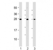 Western blot testing of HAVCR2 antibody at 1:4000: Lane 1) human HepG2, 2) Daudi and 3) kidney lysate. Expected molecular weight: 33-70 kDa depending on glycosylation level.