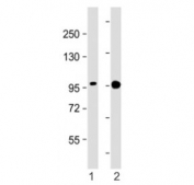 Western blot testing of SSH3 antibody at 1:2000: Lane 1) human A431 and 2) ZR-75-1 cell lysate. Predicted molecular weight ~73 kDa, can be observed at 90-95 kDa.