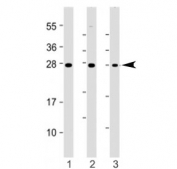 Western blot testing of ST8SIA1 antibody at 1:1000: Lane 1) human A2058 and 2) A375 cell lysate. Predicted molecular weight ~41 kDa.