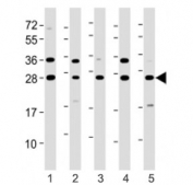 Western blot testing of ERAB antibody at 1:8000: Lane 1) human HeLa, 2) HepG2, 3) Jurkat, 4) K562 and 5) SH-SY5Y cell lysate. Predicted molecular weight ~27 kDa.