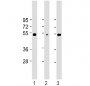 Western blot testing of RBCK1 antibody at 1:2000: Lane 1) human Jurkat, 2) HEK293 and 3) A375 cell lysate. Predicted molecular weight ~58 kDa.