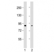 Western blot testing of SMURF2 antibody at 1:2000: Lane 1) human MDA-MB-231 and 2) U-2OS cell lysate. Predicted molecular weight ~86 kDa.