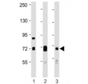Western blot testing of DLL4 antibody at 1:1000: Lane 1) mouse kidney, 2) mouse lung and 3) rat lung lysate. Predicted molecular weight ~75 kDa.