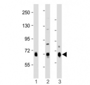 Western blot testing of DLL4 antibody at 1:1000: Lane 1) human lung, 2) mouse kidney and 3) rat lung lysate. Predicted molecular weight ~75 kDa.