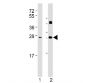 Western blot testing of DKK2 antibody at 1:2000: Lane 1) human brain and 2) mouse heart lysate. Expected molecular weight: 28-35 kDa.