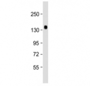Western blot testing of Klotho antibody at 1:2000 + human kidney lysate. Predicted molecular weight ~116 kDa, observed at 120-135 kDa.
