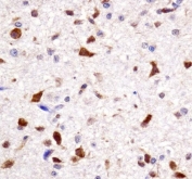 IHC testing of FFPE rat brain tissue with HOXA7 antibody.
