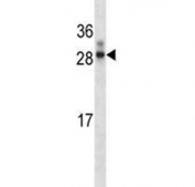 Western blot testing of HOXA7 antibody + human WiDr lysate. Predicted molecular weight ~25 kDa.