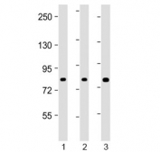 Western blot testing of human 1) HEK293, 2) HT-29 and 3) U-2 OS cell lysate with ADD1 antibody at 1:2000. Predicted molecular weight ~81 kDa.