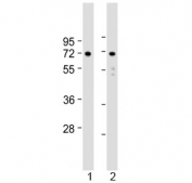Western blot testing of human 1) U-251 MG and 2) U-87 MG cell lysate with APLP1 antibody at 1:2000. Expected molecular weight: 76 kDa (unmodified), ~86 kDa (soluble/glycosylated form), 92~95 kDa (mature form).