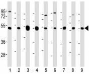 Western blot testing of mouse 1) C2C12, 2) NIH3T3, 3) brain, human 4) brain, 5) HeLa, 6) A431, 7) HEK293, 8) MCF7 and 9) rat PC-12 lysate with TUBB2A antibody at 1:2000. Predicted molecular weight ~50 kDa.