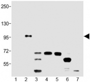 Western blot testing of 1) BRAF-600V, 2) BRAF-V600E, 3) Raji, 4) HeLa, 5) A549, 6) T47D and 7) MDA-MB-453 lysate with BRAF V600E antibody at 1:2000. Predicted molecular weight ~85-95 kDa.
