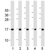 Western blot testing of human 1) 293T/17, 2) HUVEC, 3) K562, 4) NCI-H460 and 5) PC-3 cell lysate with Eotaxin-3 antibody at 1:2000. Predicted molecular weight ~11 kDa.