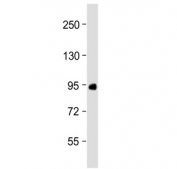 Western blot testing of human placenta lysate with Factor XIIIa antibody at 1:2000. Predicted molecular weight ~83 kDa.