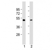Western blot testing of mouse 1) brain and 2) liver tissue lysate with Gamma Tubulin antibody at 1:2000. Predicted molecular weight ~51 kDa.