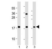 Western blot testing of human 1) HeLa, 2) THP1 and 3) RPMI 8226 cell lysate with GPX7 antibody at 1:2000. Predicted molecular weight ~20 kDa.