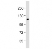 Western blot testing of human cerebellum lysate with mGluR2 antibody at 1:2000. Predicted molecular weight ~96 kDa, routinely observed at 110-120 kDa (monomer) and 220-240 kDa (dimer).