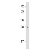 Western blot testing of human Li-7 cell lysate with IGFBP1 antibody at 1:2000. Expected molecular weight: 28-35 kDa.