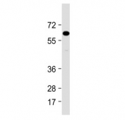 Western blot testing of mouse liver lysate with IL1RAP antibody at 1:2000. Predicted molecular weight ~65 kDa.