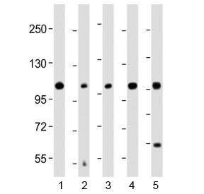 Western blot testing of human 1) COLO 205, 2) brain, 3) HeLa, 4) MCF7 and 5) SH-SY5Y lysate with KCNH1 antibody at 1:2000. Predicted molecular weight ~111 kDa.