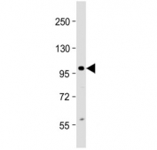 Western blot testing of human Jurkat cell lysate with CIP2A antibody at 1:2000. Predicted molecular weight: ~102 kDa, routinely observed at ~90 kDa.