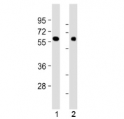 Western blot testing of human 1) kidney and 2) lung tissue lysate with MKS1 antibody at 1:2000. Predicted molecular weight ~65 kDa.