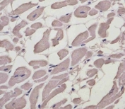 IHC staining of FFPE human heart with MYL1 antibody. HIER: boil tissue sections in pH6, 10mM citrate buffer, for 10-20 min and allow to cool before testing.