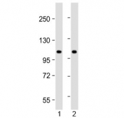 Western blot testing of human 1) lung and 2) HeLa lysate with NAT10 antibody at 1:2000. Predicted molecular weight ~116 kDa.