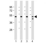 Western blot testing of human 1) Jurkat, 2) U-2 0S, 3) HeLa and 4) MCF7 cell lysate with PSMC2 antibody at 1:2000. Predicted molecular weight ~49 kDa.