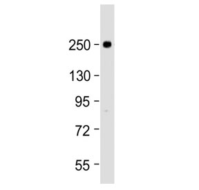 Western blot testing of human U-87 MG cell lysate with SCN1A antibody at 1:2000. Predicted molecular weight ~229 kDa, routinely observed at ~250 kDa.~