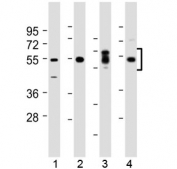 Western blot testing of human 1) kidney, 2) lung, 3) placenta and 4) HeLa lysate with SGK1 antibody at 1:2000. Predicted molecular weight of isoforms 1/2/3: ~42/49/60 kDa.