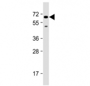 Western blot testing of human U-251 MG cell lysate with SH2B3 antibody at 1:2000. Predicted molecular weight ~63 kDa.