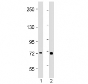 Western blot testing of human 1) placenta and 2) Jurkat lysate with TAP2 antibody at 1:2000. Predicted molecular weight ~76 kDa.