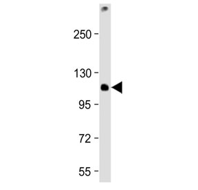 Western blot testing of mouse EL4 cell lysate with TCIRG1 antibody at 1:2000. Predicted molecular weight ~93 kDa, routinely observed at ~116 kDa.~