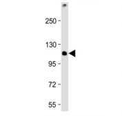 Western blot testing of mouse EL4 cell lysate with TCIRG1 antibody at 1:2000. Predicted molecular weight ~93 kDa, routinely observed at ~116 kDa.