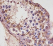 IHC testing of FFPE human testis tissue with TGFBR3 antibody. HIER: steam section in pH6 citrate buffer for 20 min and allow to cool prior to staining.