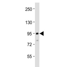 Western blot testing of human MCF7 cell lysate with TGFBR3 antibody at 1:2000. Predicted molecular weight ~94 kDa.