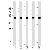 Western blot testing of human 1) brain, 2) K562, 3) Jurkat, 4) HepG2 and 5) A431 lysate with TSG101 antibody at 1:2000. Predicted molecular weight ~45 kDa.