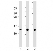Western blot testing of human 1) SH-SY5Y, 2) A431 and 3) HeLa cell lysate with Thioredoxin antibody at 1:2000. Predicted molecular weight ~12 kDa.