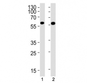 Western blot testing of 1) human HepG2 and 2) rat liver lysate with GCK antibody. Predicted molecular weight ~52 kDa.